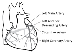 Coronary Arteries